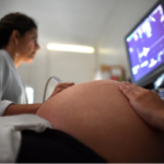 Mulher passa por ultrassom em consulta médica Mortalidade materna
