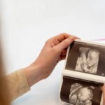 Aborto ou assassinato? Chile pode obrigar mulheres a ouvir coração do feto antes de procedimento