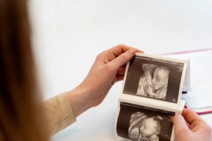 Aborto ou assassinato? Chile pode obrigar mulheres a ouvir coração do feto antes de procedimento